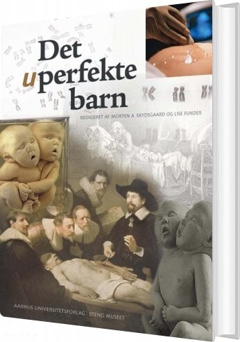 Det Uperfekte Barn - Lars Ole Andersen - Bog - Aarhus Universitetsforlag