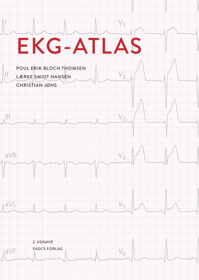 Ekg-atlas - Poul Erik Bloch Thomsen - Bog - Fadls Forlag
