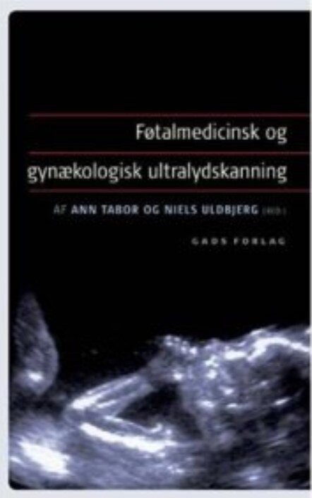 Føtalmedicinsk Og Gynækologisk Ultralydskanning - Ann Tabor - Bog - Gads Forlag