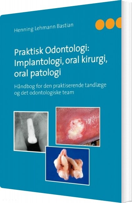 Praktisk Odontologi: Implantologi, Oral Kirurgi, Oral Patologi - Henning Lehmann Bastian - Bog - Books On Demand